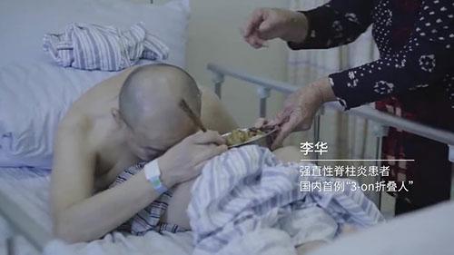 身體被敲斷4次的折疊人出院，打開(kāi)折疊人生(圖2)