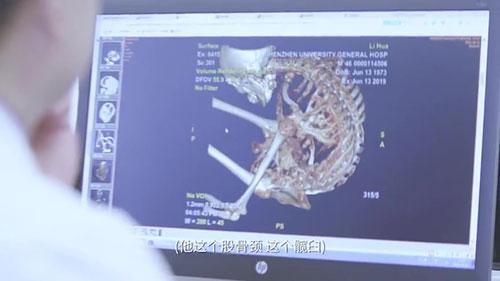 身體被敲斷4次的折疊人出院，打開(kāi)折疊人生(圖6)