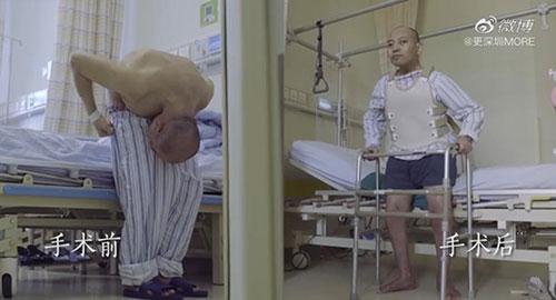 身體被敲斷4次的折疊人出院，打開(kāi)折疊人生(圖15)