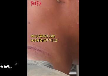 抗洪戰(zhàn)士疼得直叫依然說(shuō)沒(méi)事兒 現(xiàn)場(chǎng)圖曝光令人鼻酸(圖2)